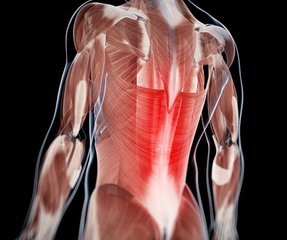 multifidus muscle pain